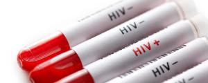 Разберёмся, в каких ситуациях тестирование на ВИЧ делают добровольно, а в каких проверка на ВИЧ-инфекцию является обязательной